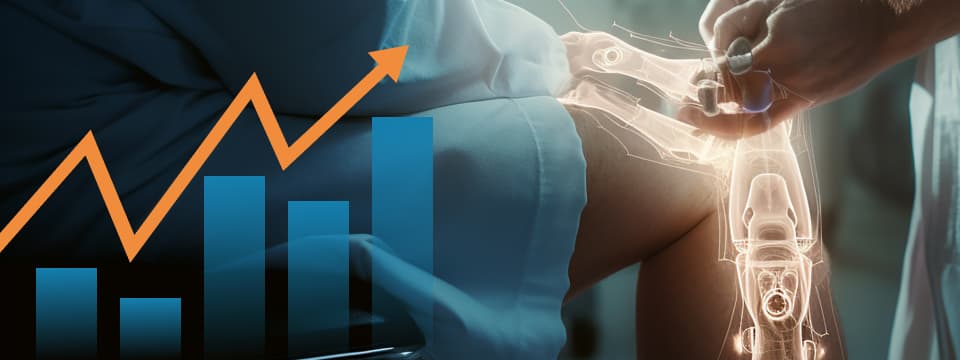 Joint replacement services