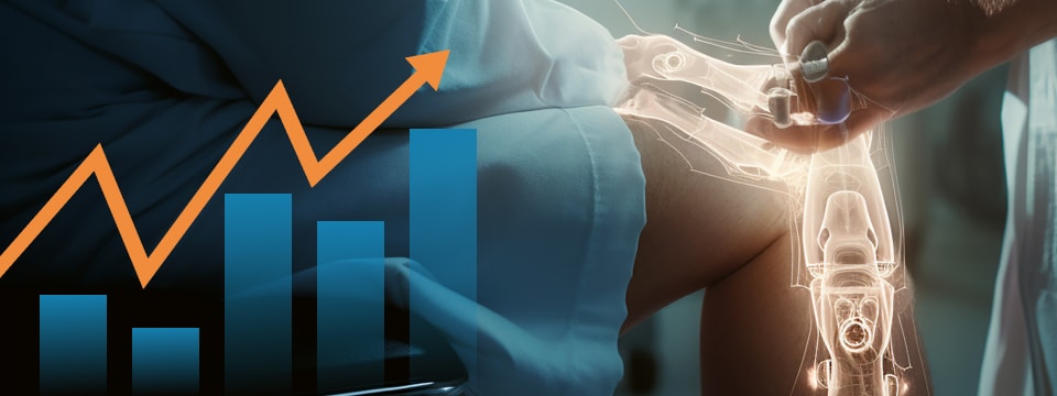 Joint replacement services